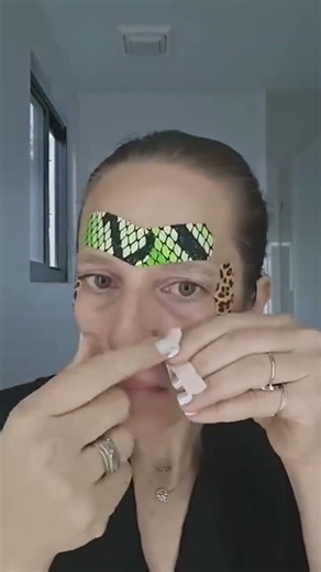 Smooth Out Nasolabial Folds with Beauty Taping! ✨ . Beauty taping is a simple, non-invasive way to