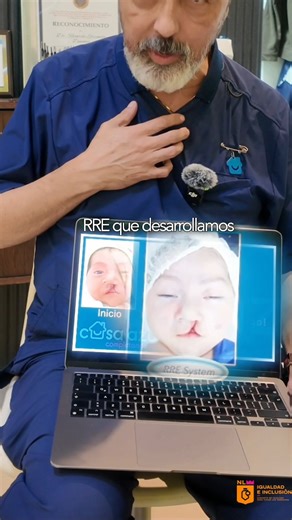 💙 En Casa Azul no solo completamos sonrisas. Nuestra verdadera intención es darle a cada niño con labio y paladar hendido la oportunidad de vivir una niñez, adolescencia y adultez digna, con salud, confianza y las mismas oportunidades que todos los niños para su futuro. ✨ Porque una sonrisa transforma más que un rostro: transforma una vida entera, completa una sonrisa. Casa Azul ✉️ casaazulac@hotmail.com 📞 WhatsApp 818 478 8404 | Casa Azul A.C.