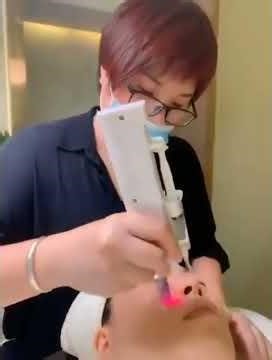 Dermabrasion Meso Mesotherapy Machine #vacuum #rf