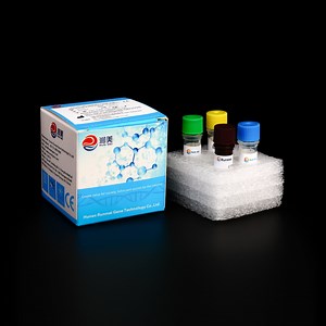 [Hot Item] Ivd PCR Reagents CT Ng Mg Multiplex PCR Nucleic Acid Detection Kit