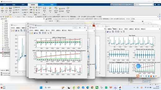 【心电信号ECG】基于matlab心电图去除信号+消除50Hz干扰+提高信噪比+心率+QRS波群【含Matlab源码 13934期】