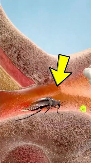 If a Cockroach Crawls Inside Your Ears... Do this instead