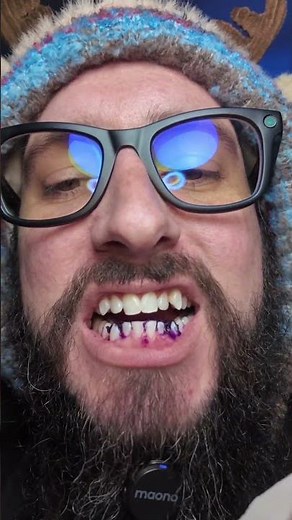 Fast Results with Hismile V34 Whitening Strips 😳💜 Try It in 30 Minutes! #TeethWhitening #BeautyHacks