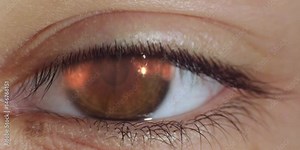 Closeup eye with reflection nuclear explosion and fire. Macro shot on RED 4K.