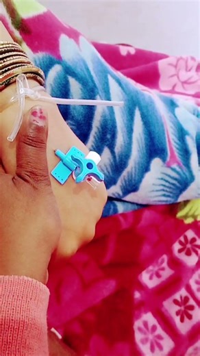 22G cannula fixed in #music #love