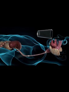 924K views · 10K reactions | China-Made AI Capsule Endoscope Enables...