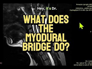 What Does the Myodural Bridge Do?