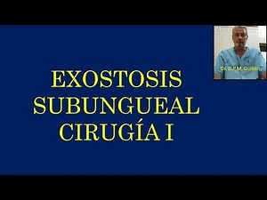 Exostosis subungueal Cirugía Podología Dr Guillén