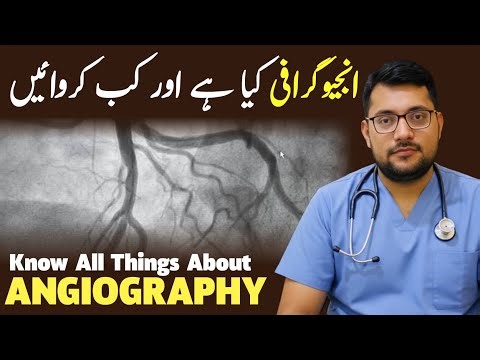 What Is Angiography? When You MUST Get This Heart Test