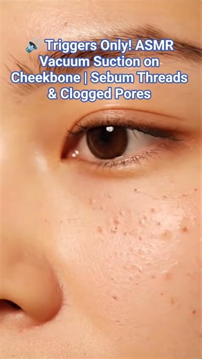 ​🔊 Triggers Only! ASMR Vacuum Suction on Cheekbone | Sebum Threads & Clogged Pores #asmr #relax