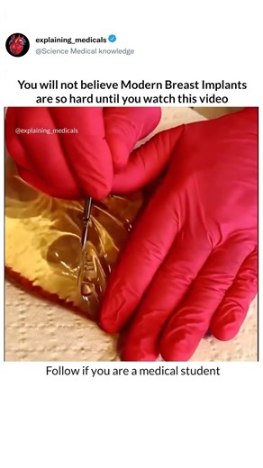 You will not believe modern breast🤱🏻 implants are so hard until you watch this video 🩺#trending