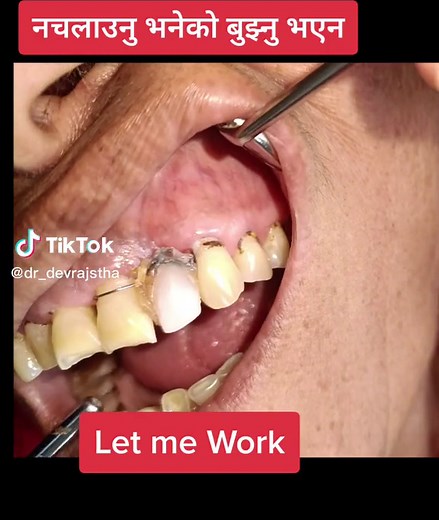 Understanding Scurvy for Better Oral Health