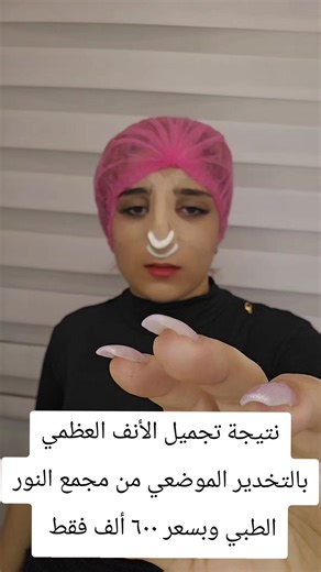 ‏#تجميل_الأنف #دكتورة_نور_امين #مجمع_النور_الطبي