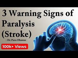 3 Warning Signs of Paralysis (Stroke)