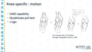 Examination of the Unstable Patella