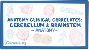 Anatomy clinical correlates: Cerebellum and brainstem: Video, Causes, & Meaning | Osmosis