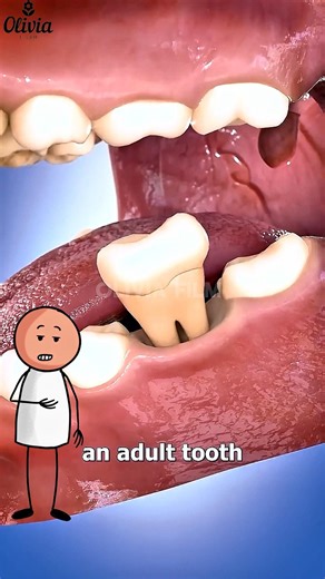 🦷 What Happens When a Tooth Falls Out? Inside the Human Body (3D Animation) #health #support #viral