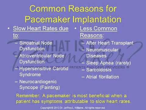 Pacemaker Patient Education Lecture 2: Reasons for Pacemaker Implantation