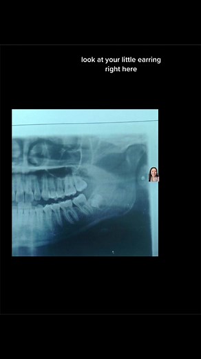 Removing a Claire's Earring Back After 14 Years | Earring Lock and Ball Stuck