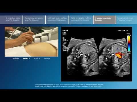 Advanced screening views of the fetal heart - Part 5 - 3-vessel view color Doppler