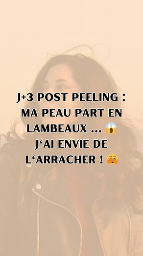 𝗝𝗼𝘆 | 𝗠𝗮𝗺𝗮𝗻 𝗮𝗺𝗯𝗶𝘁𝗶𝗲𝘂𝘀𝗲 ✨ on Instagram: "•• 𝗝+𝟯 Exceptionnellement, deuxième vidéo du jour mais j'avais envie de partager avec vous ce moment ... Ce petit bout de peau qui s'est détaché tout au long de la matinée au boulot ... Et qui nous a valu de grands fou-rire avec les collègues d'ailleurs 🤣 Qui l'aurait arraché ? On est d'accord que c'est hyper tentant quand même 😅 #acne #acné #peeling #cicatrices #cicatricesacné #acnéadulte #acnéfemme #acnéhormonal #skincare #teatree #