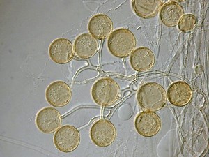 Glomus (fungus) - Alchetron, The Free Social Encyclopedia