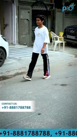 Best Prosthetic Legs in India #Artificial_limb | P&O International Limb Center