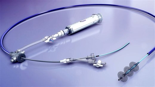 Inari Catapults — Again — After Stryker Confirms $4.9 Billion Deal