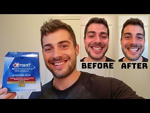 Crest 3D Whitestrips - How To Whiten Your Teeth At Home ( Full 14 Days Review )