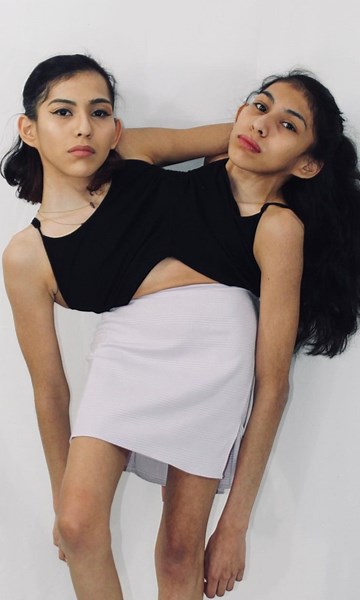 Conjoined twins: One has a BF and one is asexual