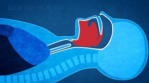 Are you bothered by snoring...?  Whether you’re the snorer or you...