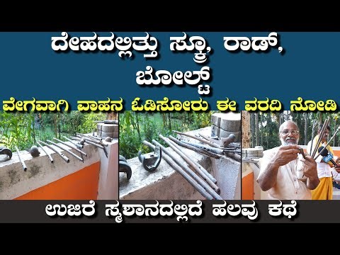 ವೇಗವಾಗಿ ವಾಹನ ಓಡಿಸೋರು ಈ ವರದಿ ನೋಡಿ|ದೇಹದಲ್ಲಿತ್ತು ಸ್ಕ್ರೂ,ರಾಡ್,ಬೋಲ್ಟ್|ಉಜಿರೆ ಸ್ಮಶಾನದಲ್ಲಿದೆ ಹಲವು ಕಥೆ|