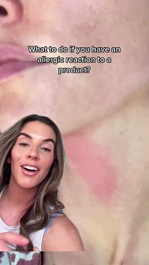 what products have you had reactions to?? #skincaretips #skincarereactions #skincaresolutions