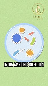 All about “Dry labor” | The Queen’s Clinic