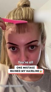 She tried to fix her hairline but made things SO much worse… 😭 | Happiest