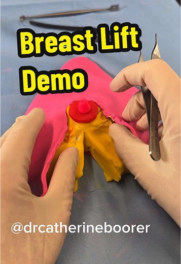 Breast Lift Surgery Benefits and Expectations