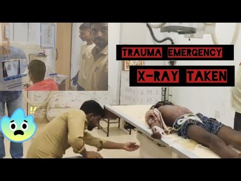 Trauma emergency patient||accident patient x ray #medical #video#zarooratrishta #marriagecentre