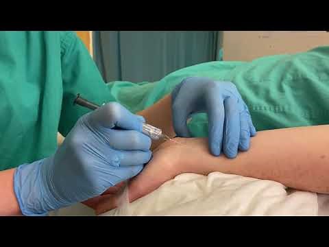 How to take and arterial blood gas sample