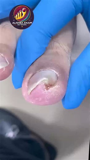 How American Seniors Maintain Thickened Toenails For American Seniors #HealthyHabits #FootWellnessUSA #SimpleHealthTricks #NailCareTips | Alishba Anjum vlog