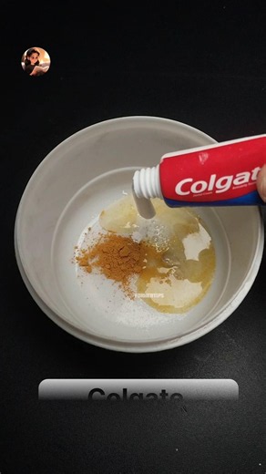 Teeth Whitening at Home 🦷 | Turmeric + Baking Soda + Lemon + Salt Remedy | Remove Yellow Teeth