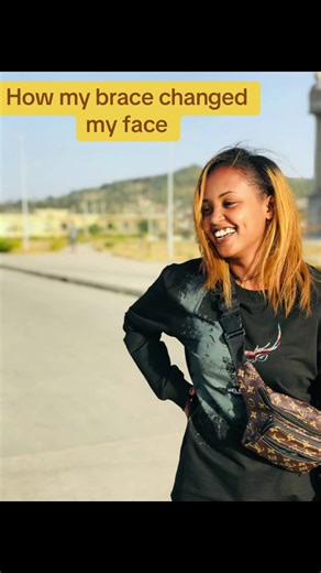 Braces Journey: How My Smile Transformed