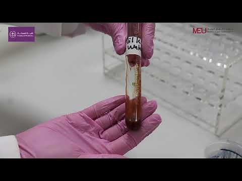General Biology Lab - Identifying lipids (sudan black dye test)