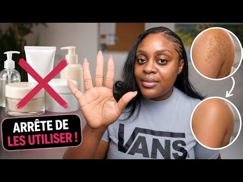 Pourquoi tes taches ne disparaissent pas ? Comment enlever les taches sur ton corps .