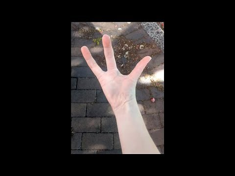 this girl was born with only 3 fingers...