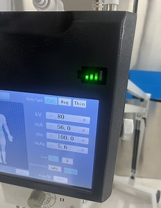 [Hot Item] Revolutionize Healthcare with The Ultimate Portable Digital X-ray Machine