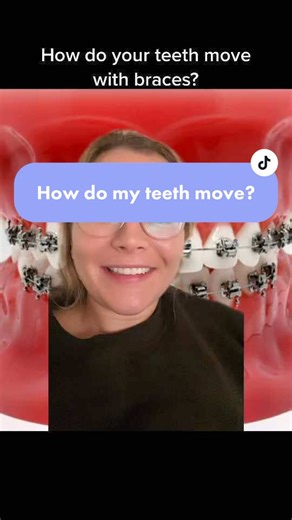 Understanding How Teeth Move with Braces