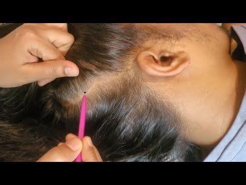 The Most Satisfying Scalp Check ASMR Ever 🤯 | Instant Relaxation ✨
