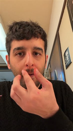 NAEIM on Instagram: "First time using blood wax for a bloody nose effect or scabs. • • • #Specialfx #makeup #mehron #art #youngartist"