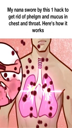 My nana swore by this one simple hack to ease chest and throat mucus — and when she showed me how it works, I couldn’t believe it | Health Tips Tricks