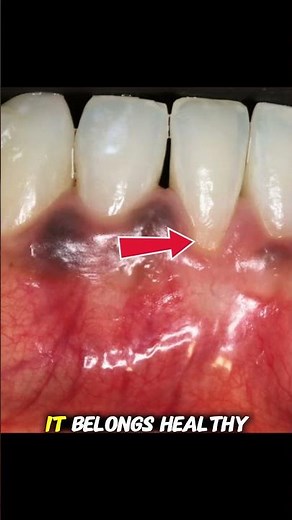 This ONE Tooth Was Destroying His Smile 😳🦷